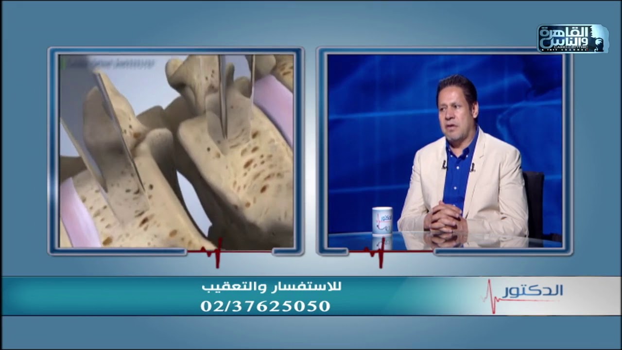 الغضاريف الصناعية مصدر قلق للمرضى علشان كده لازم تصحح مفهومك عنه من الفيديو ده