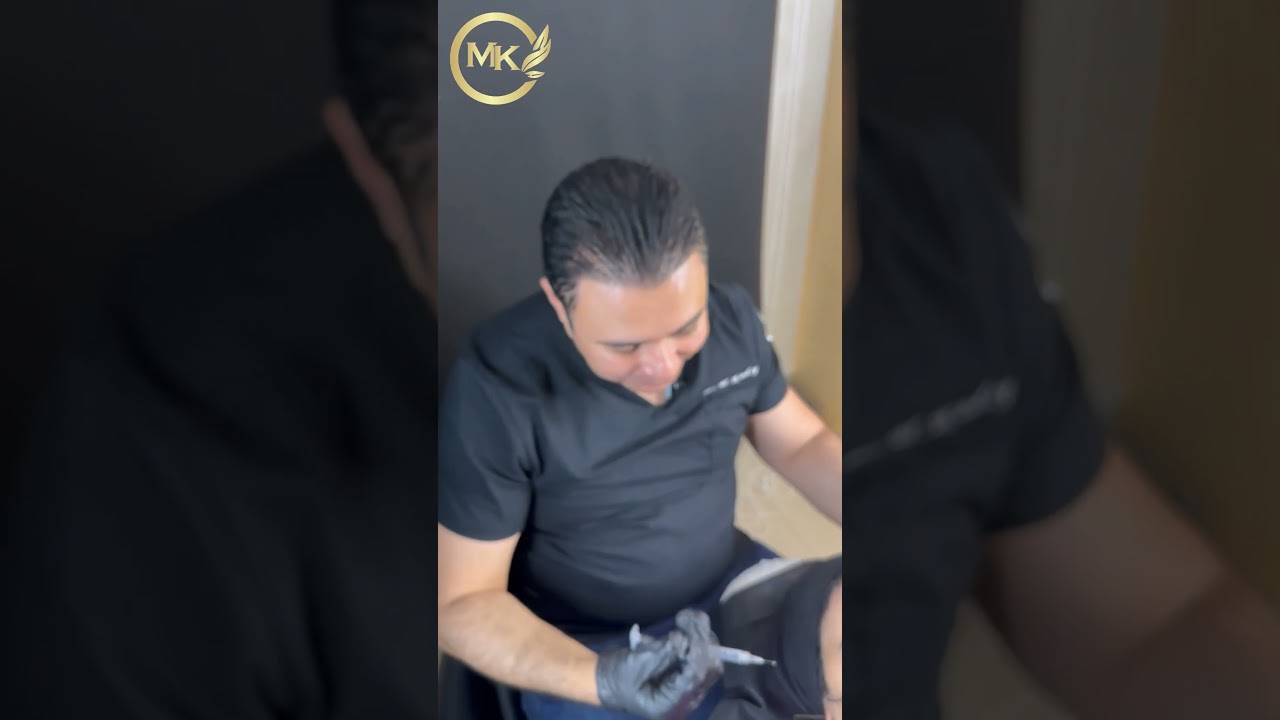 شد الخد ورفعة باستخدام حقن الفيلر | cheek elevation and volumizing with filler  #filler  #skincare