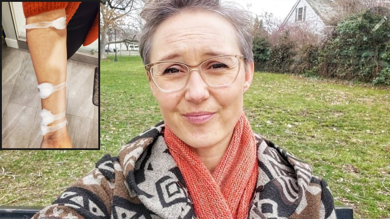 Do I Regret Not using a Port for Chemo... What Blood Draws are like Now | Breast Cancer Survivor