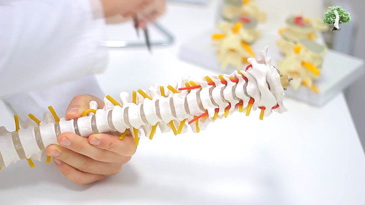 Vertebral artery syndrome symptoms, treatment, diagnosis, causes