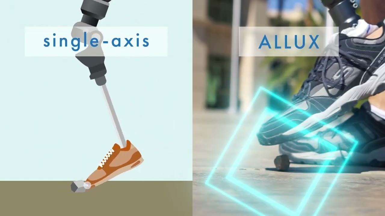 Колінний вузол з мікропроцесором Allux ( Nabtesco, Японія) загальний выдео огляд