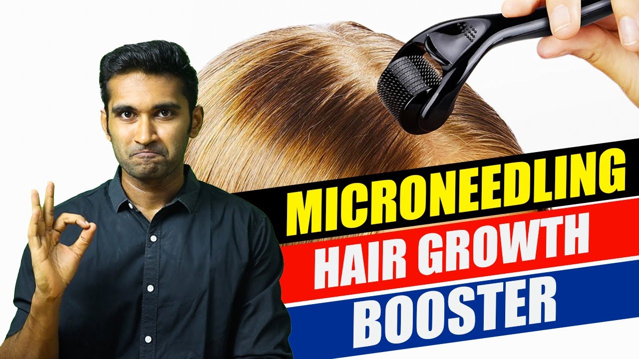 How to do MICRO-NEEDLING at home for HAIR GROWTH?.(தமிழ்) 