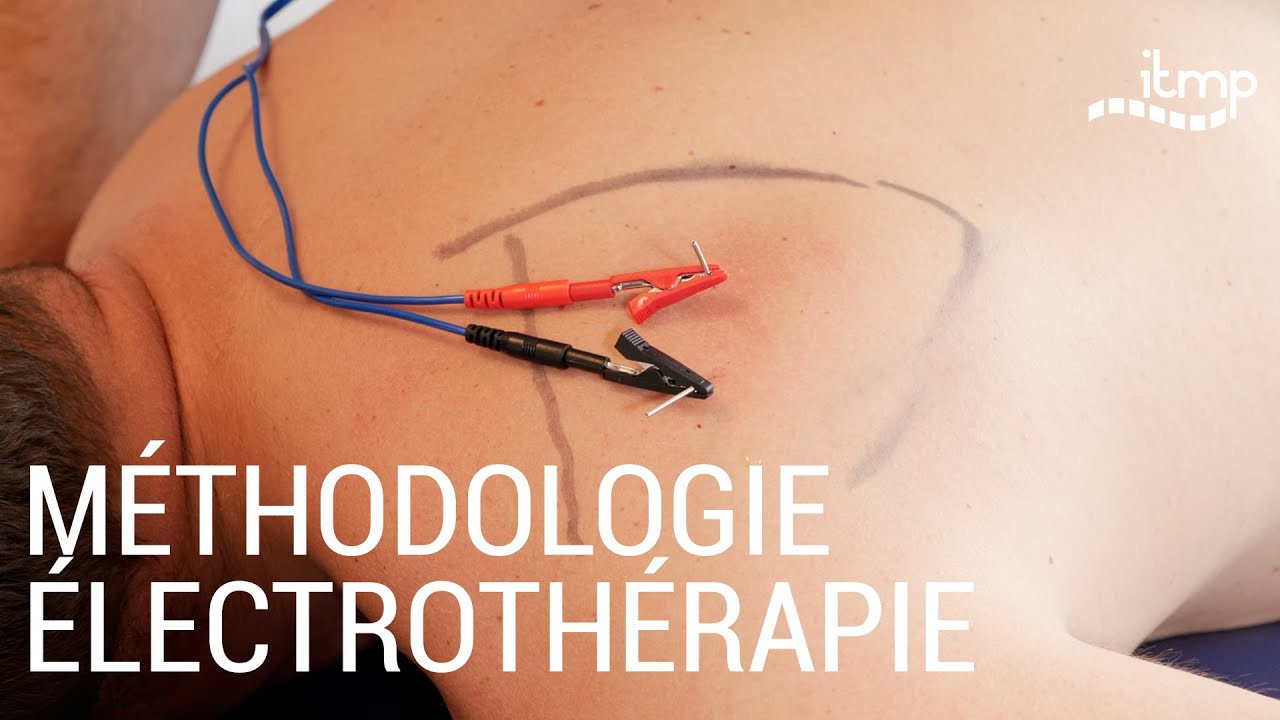 MÉTHODOLOGIE DRY NEEDLING et ÉLECTROTHÉRAPIE