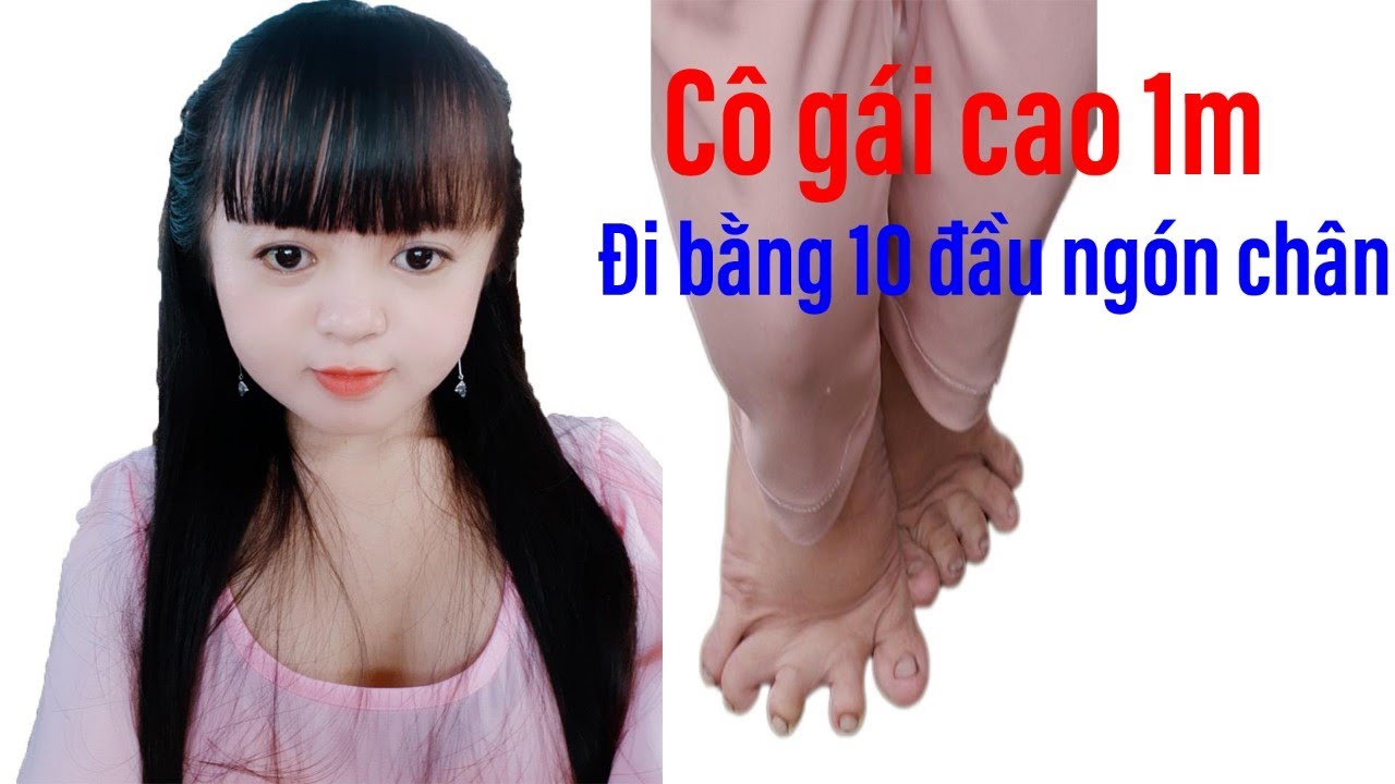 Kỳ lạ chuyện cô gái đi trên 10 đầu ngón chân có biệt danh Nàng út ống tre II ĐỘC LẠ BÌNH DƯƠNG