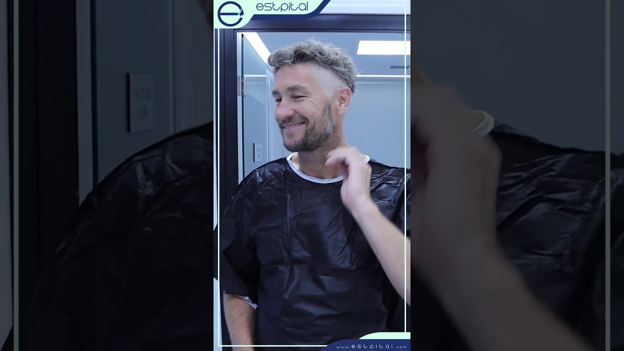 Hair transplantation with DHI Method - Estpital Clinic