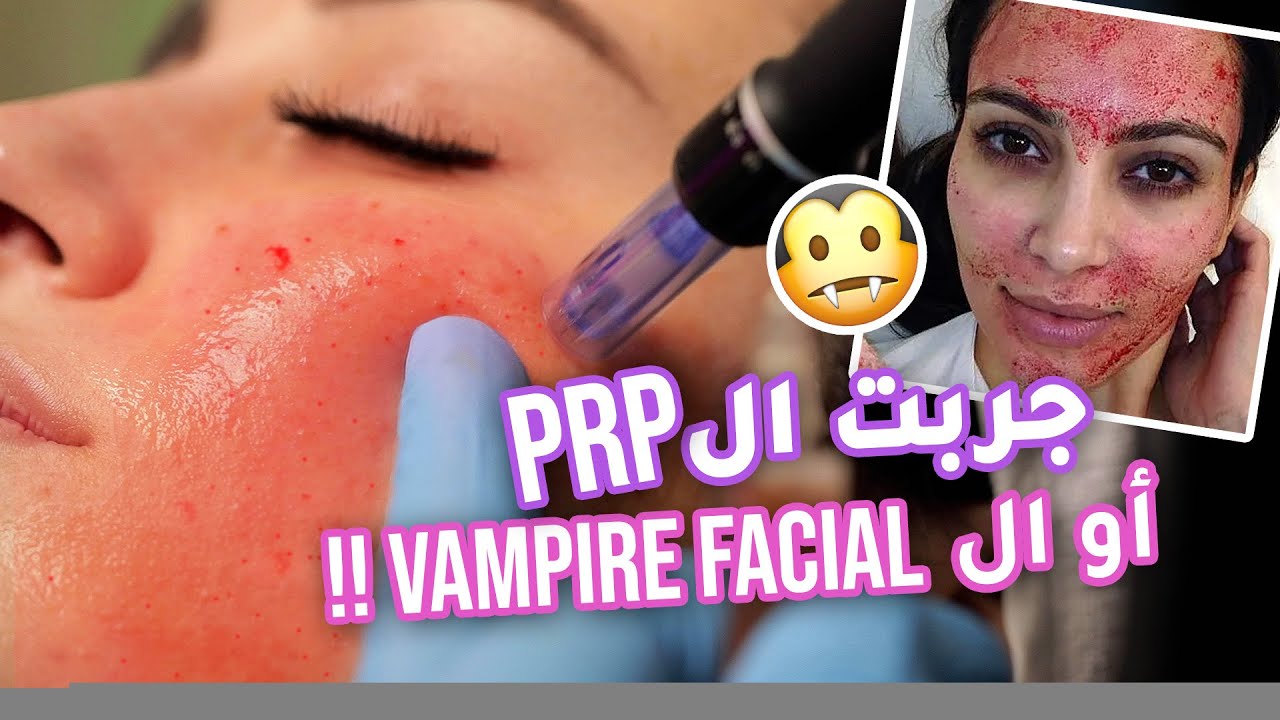 جربت تقنية ابر النضاره 😱 
