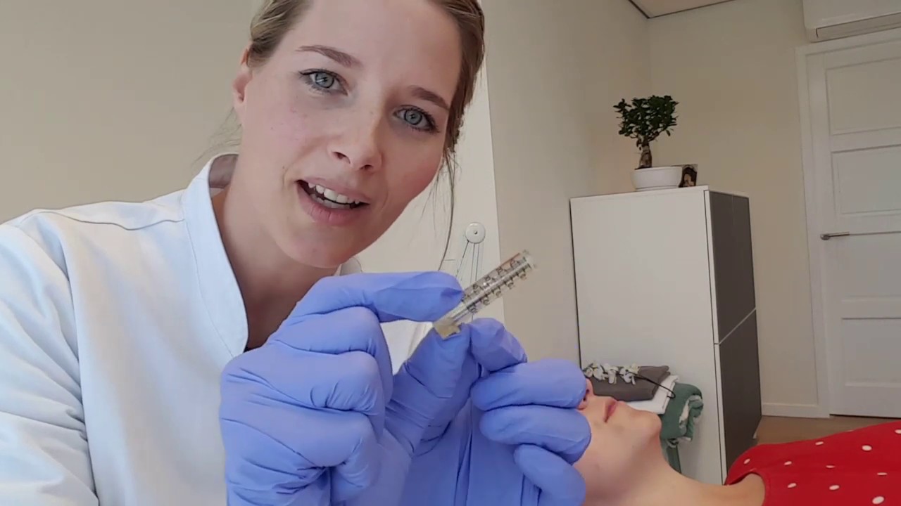 Vlog #3: Vollere lippen met de hyaluronpen