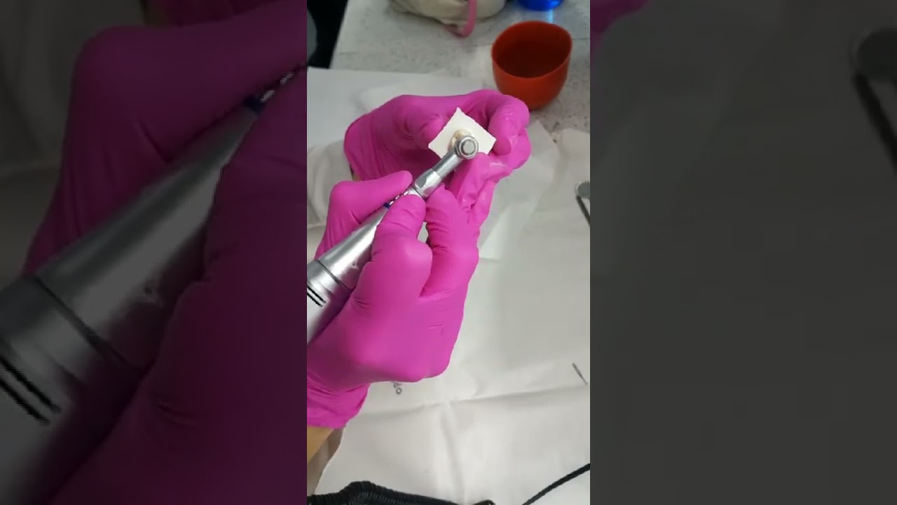 Üst 1 molar giriş kavitesi demosu