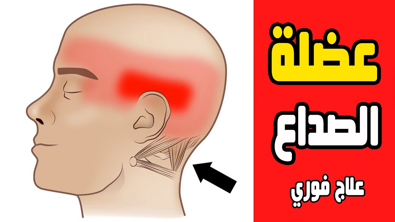 Головная боль ||  Затылочная невралгия ||  Откройте для себя новейшие технологии помощи