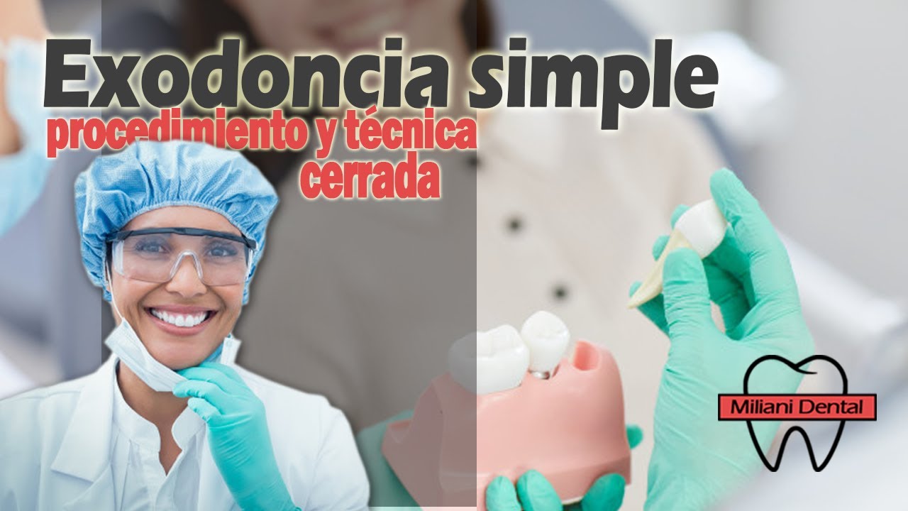 ¿Cómo se extrae un diente? - Procedimiento y técnica simple