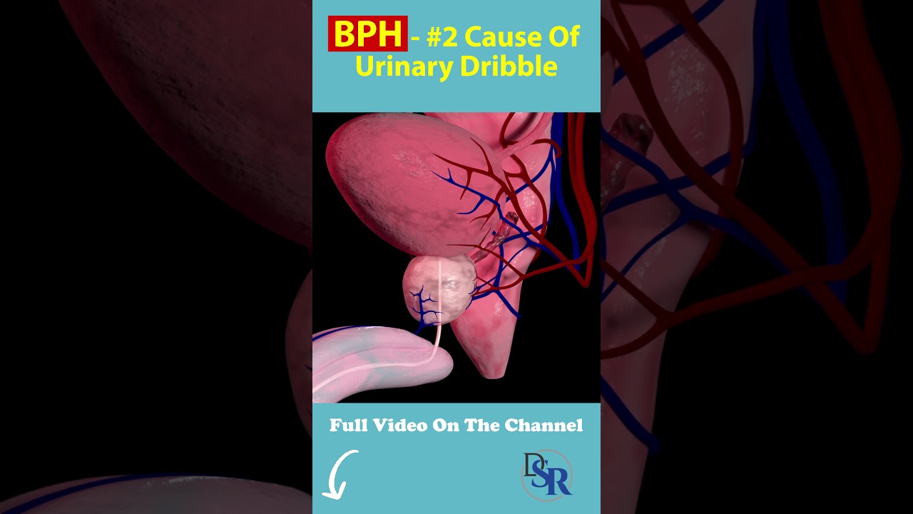 The #2 Cause Of Urinary Dribble