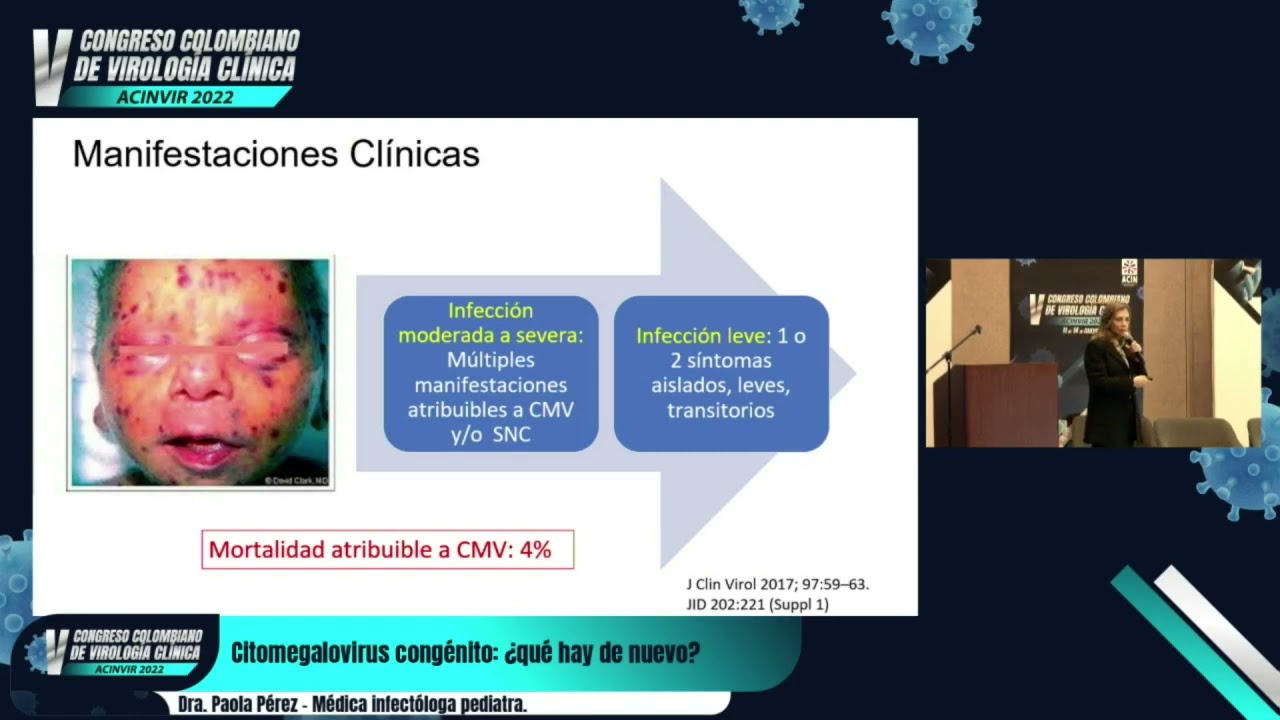 Citomegalovirus congénito: ¿Qué hay de nuevo? - Dra. Paola Pérez