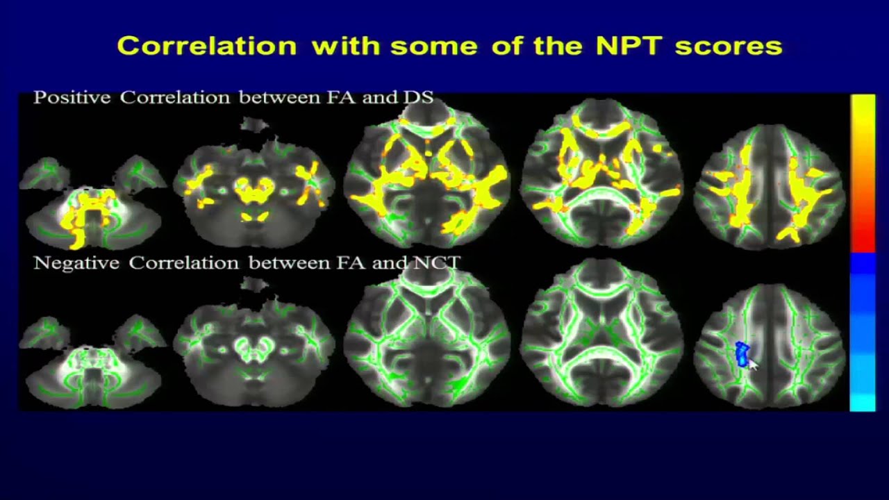 Mod-05 Lec-26 Brain microstructural correlates of cognition in vitamin B12 deficiency