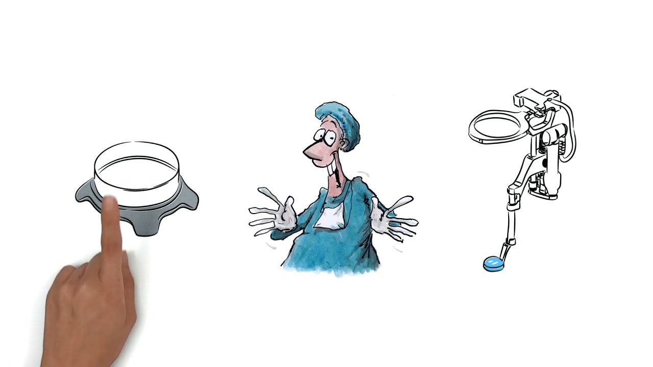 HD Disposable LenZ Zeiss Resight® de OCULUS Surgical