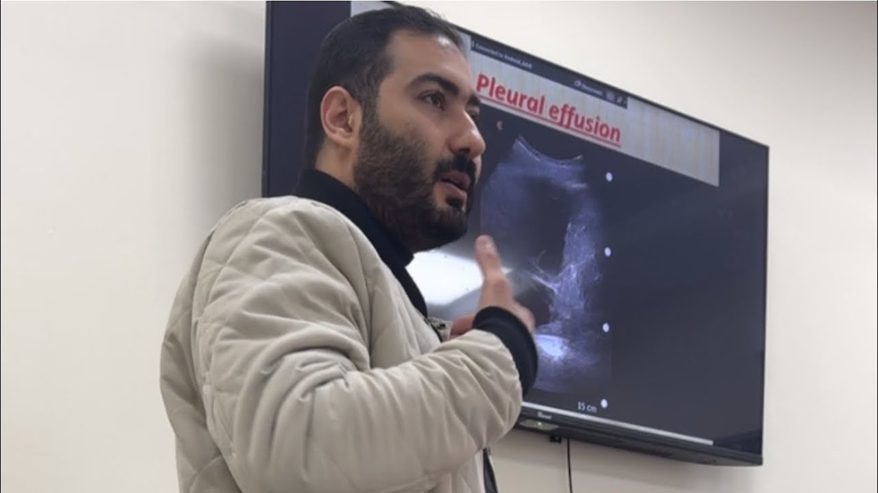 Pleural effusion chest ultrasound