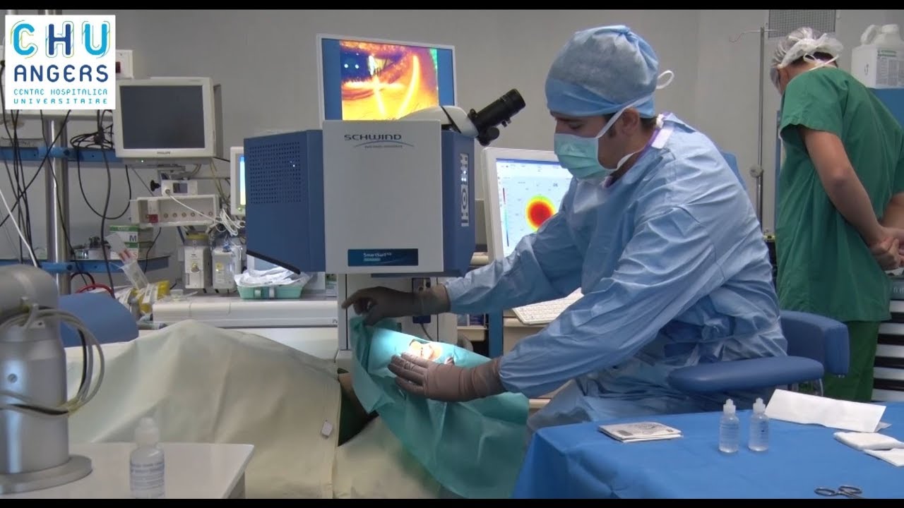 La chirurgie au laser en ophtalmologie du CHU Angers