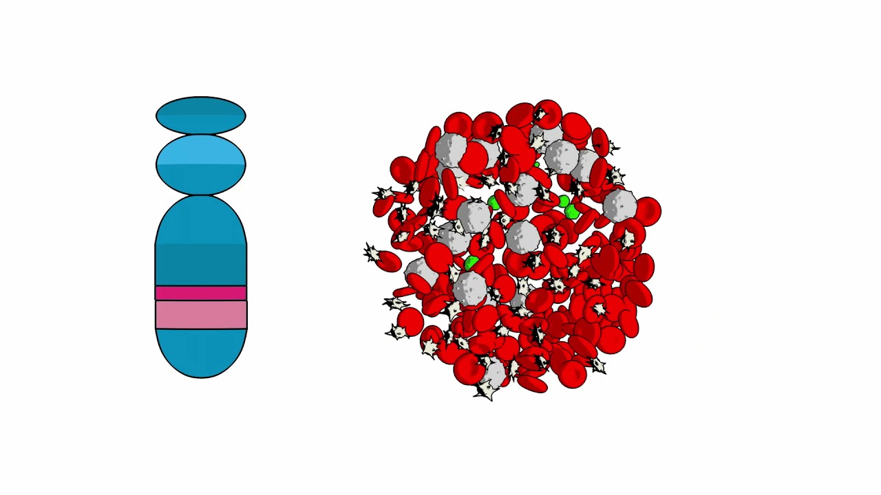 Chronic myeloid leukemia (CML) and your genes
