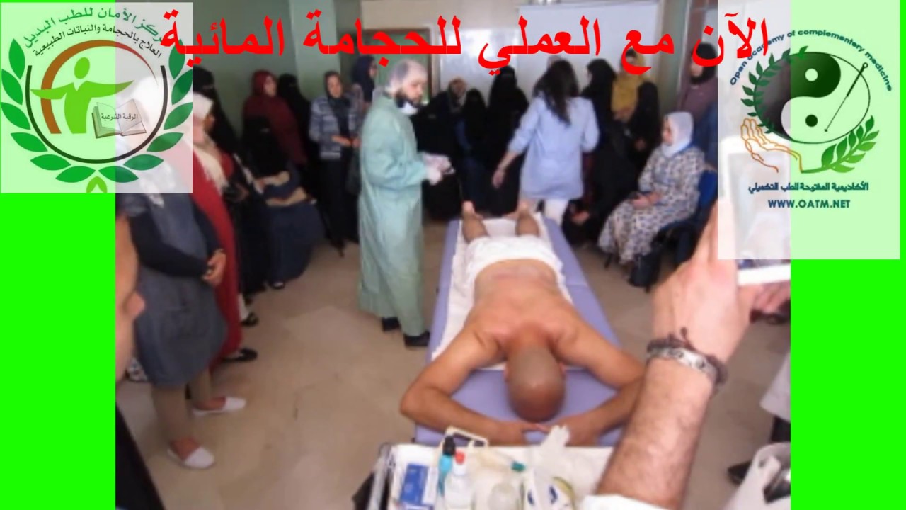 حجامة مائية لخفض حرارة الجسم سريعا مع دكتور محمود الشعراوي