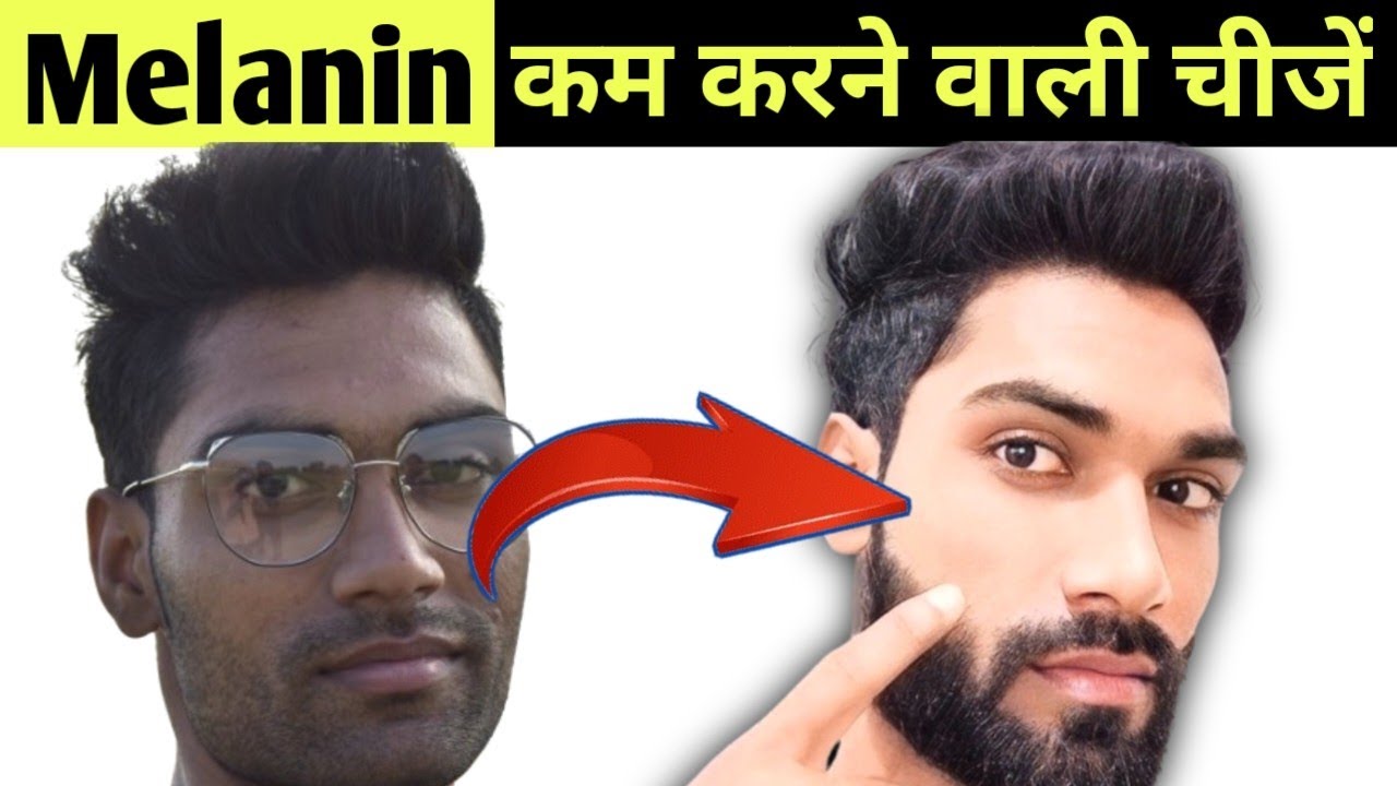Melanin kam karne ke upay | Melanin pigment ko kam kaise kare