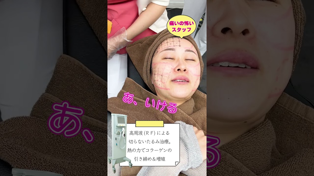 【スタッフ涙目】「サーマクール」で引き締め＆リフトアップ 