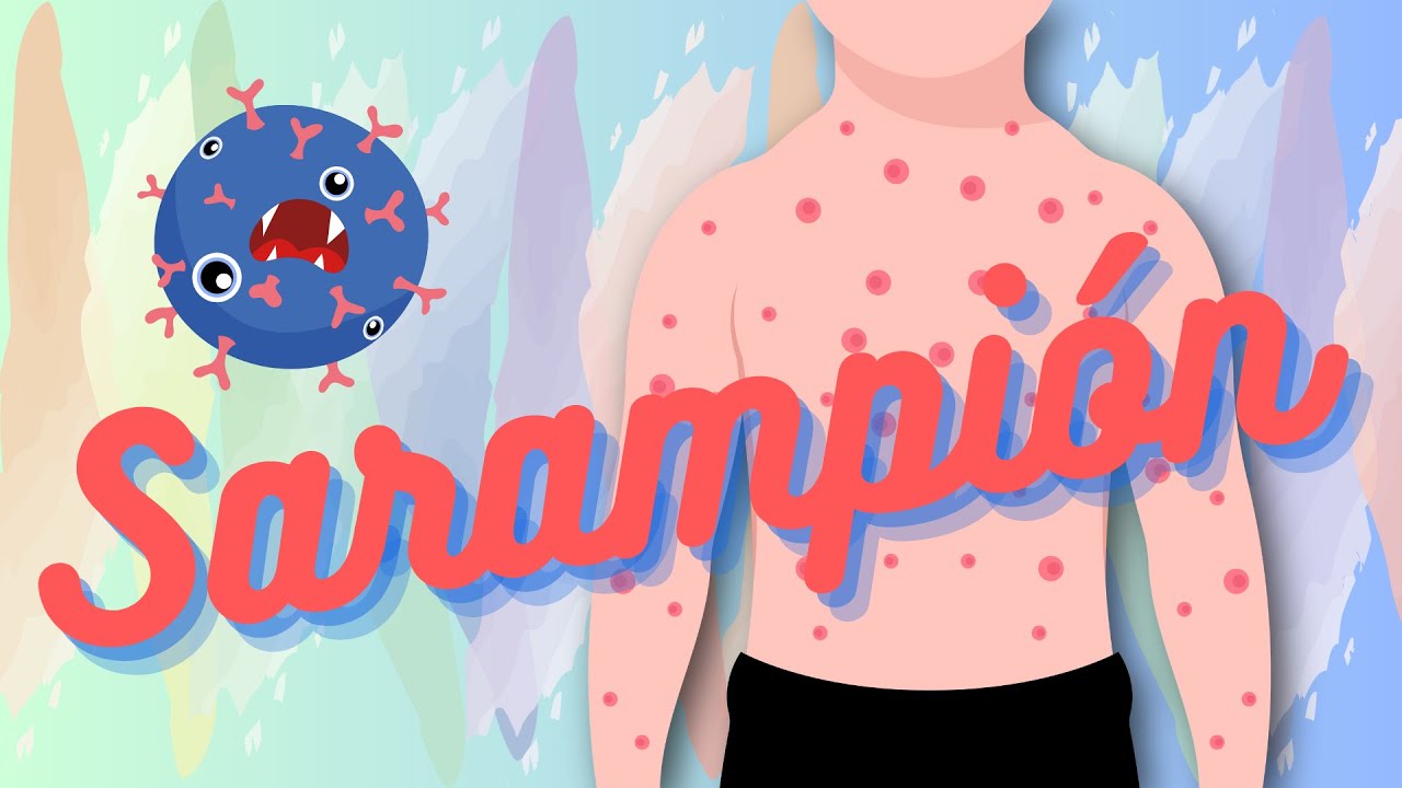 SARAMPIÓN