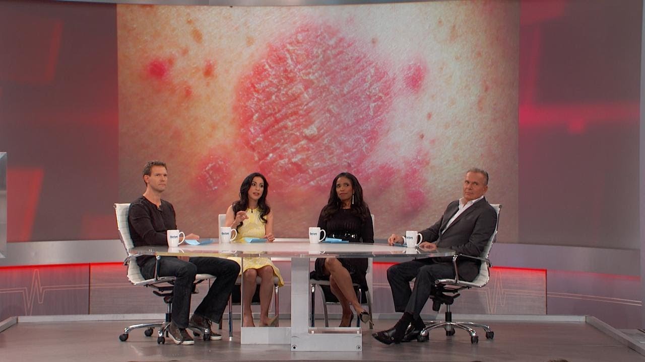 Could This Happen to Me?: Nummular Dermatitis