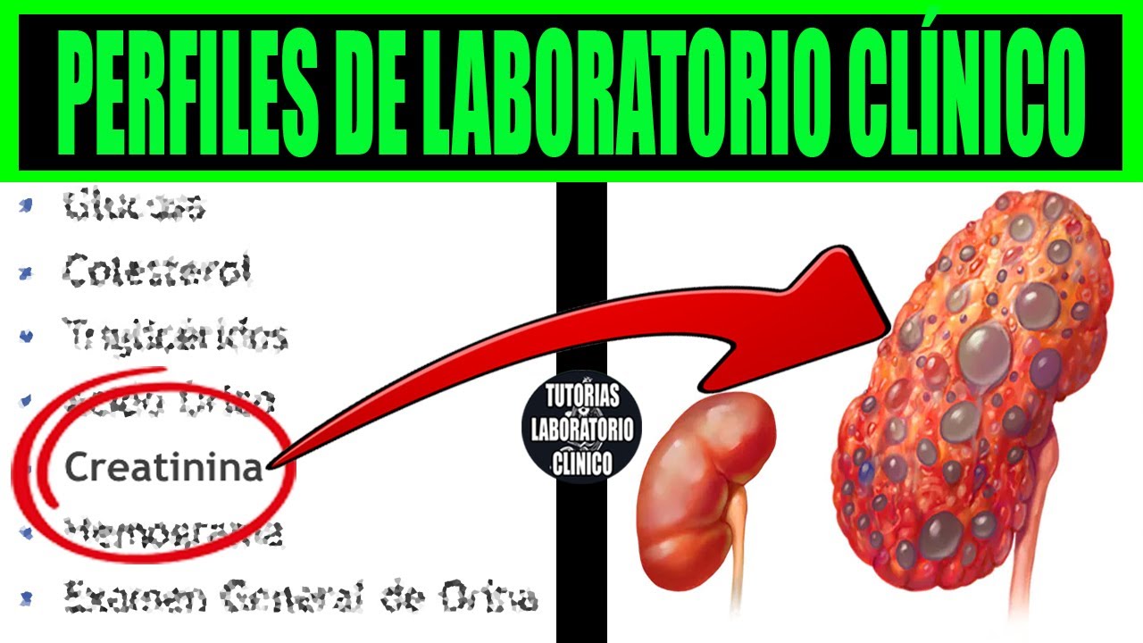 🔬Te Explico TODOS los Perfiles de Laboratorio Clínico ¿Por qué y Para que Sirve Cada Examen?❤️