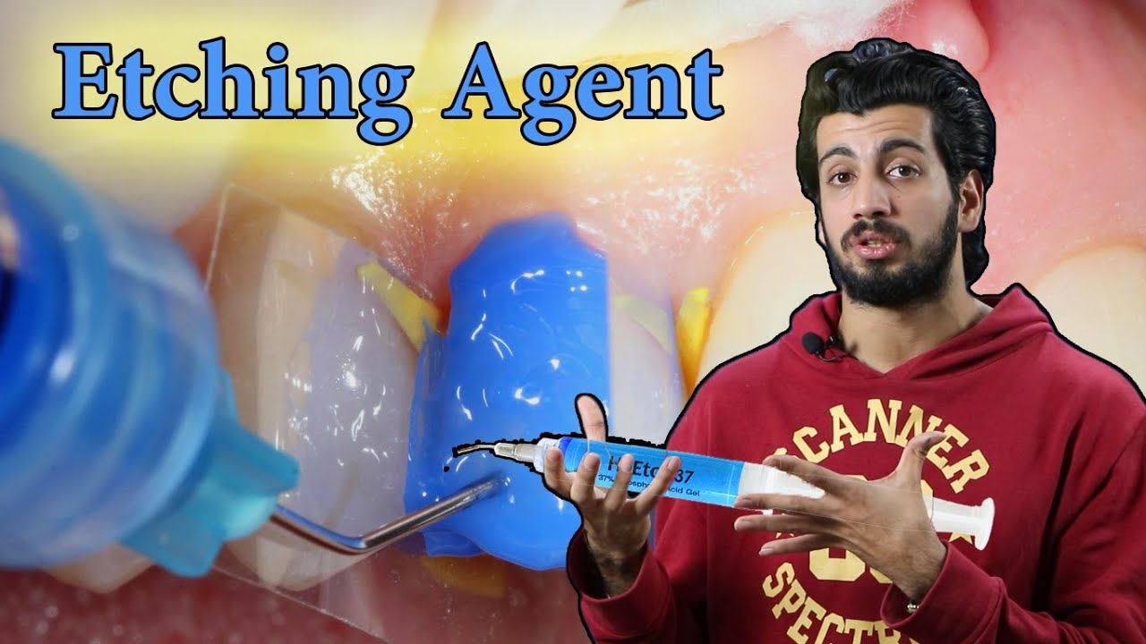 Dental Etching Agent : تأثير مادة الاجنك على انسجة السن