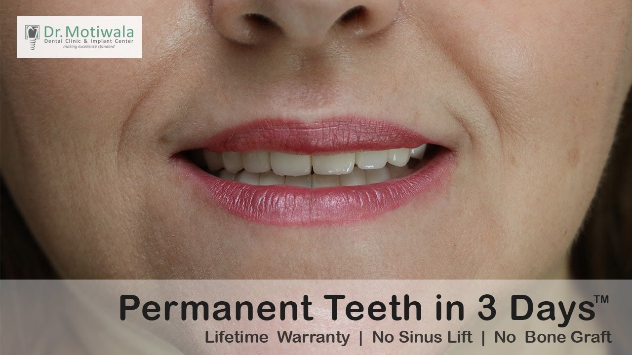 Sophie from, USA relates her experience of full mouth dental implants in India | Perfect Dentist