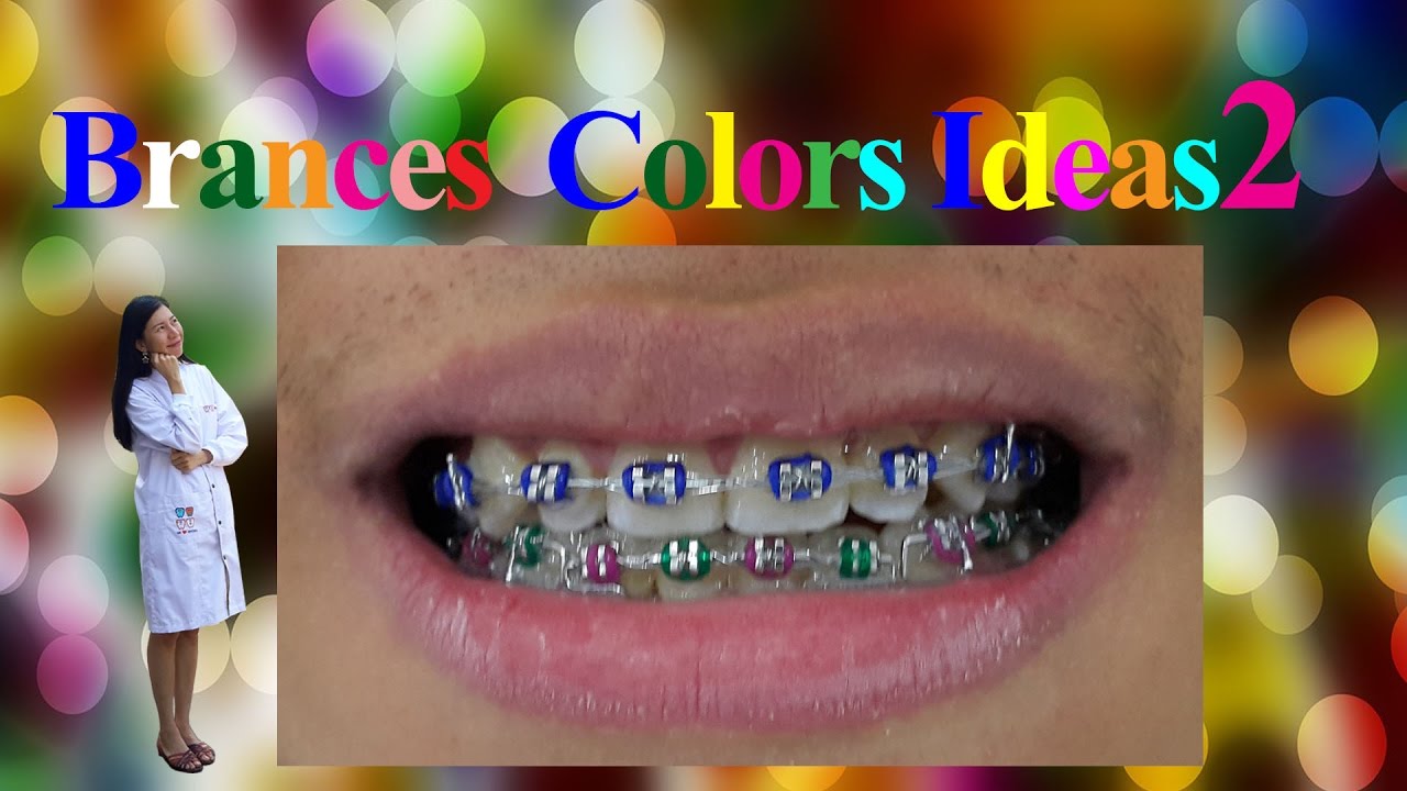 Brance Colors Ideas 2