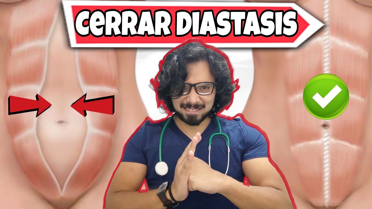 Rutina de Ejercicios en Casa para CERRAR la DIASTASIS ABDOMINAL (di&aacute;stasis de rectos)