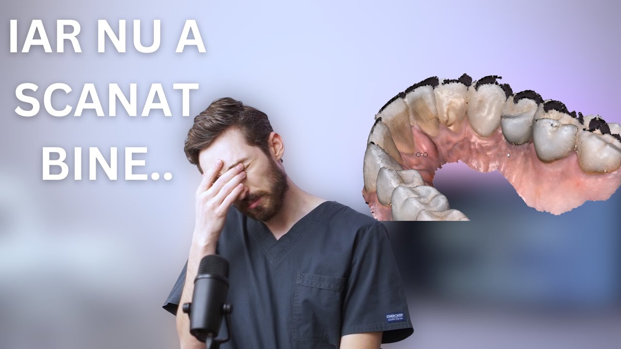 Cele mai comune 5 greșeli în scanarea intraorală (și cum se evită)