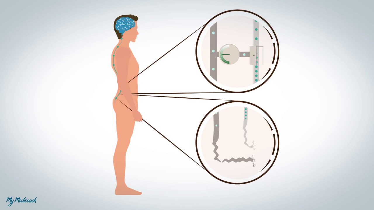 Douleurs neuropathiques et dysfonctionnelles: explication.