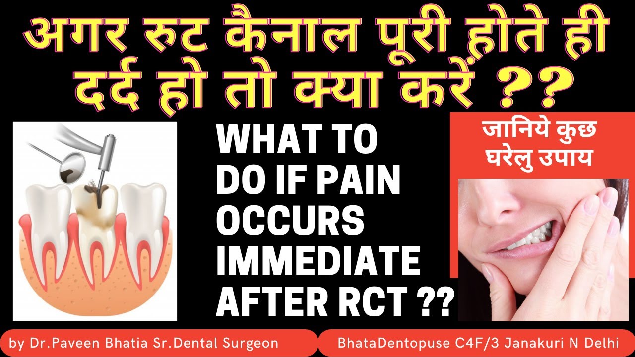 what to do if pain starts immediate after root canal-अगर रुट कैनाल पूरी होते ही दर्द हो तो क्या करें