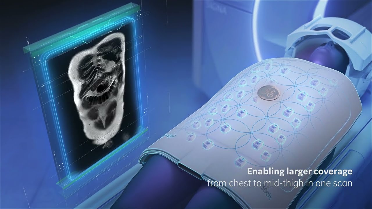 MRI with AIR Touch&trade; Solution (3D animation by Arcreative 2023)