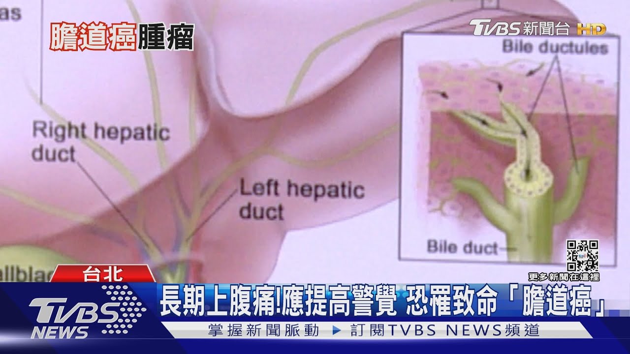 不常被討論沉默殺手「膽道癌」 國衛院研發...這藥物 ...延長存活期!｜十點不一樣20220301
