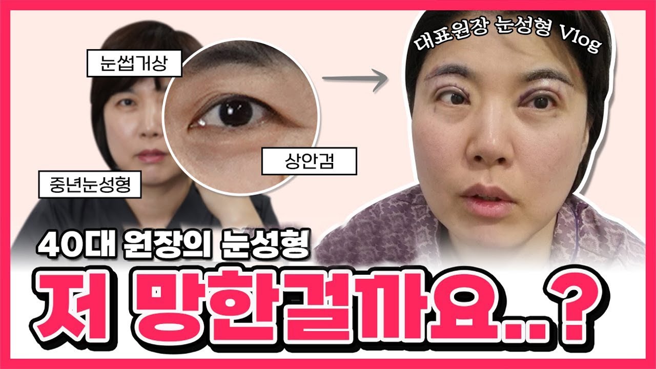 갑자기 성형수술을 받은 피부미용 대표원장 VLOG  😨 상안검, 눈썹거상 🐶망한 후기❓