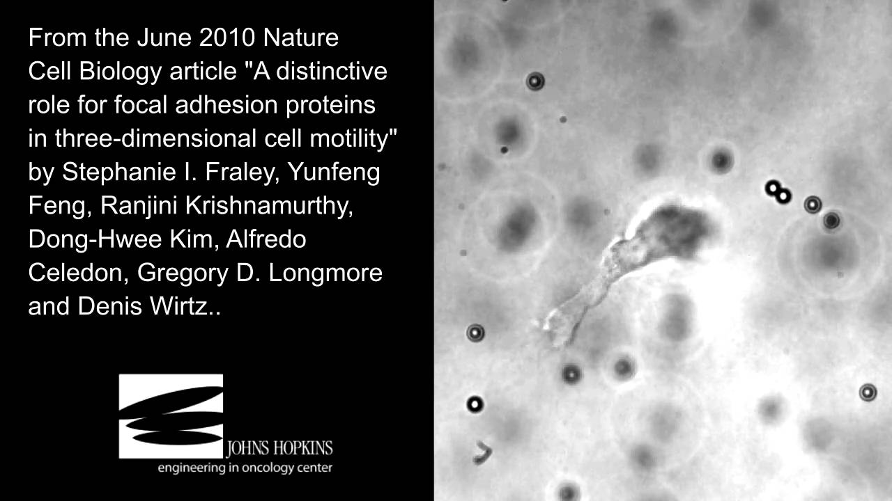Cancer cells pulling on 3D collagen matrix