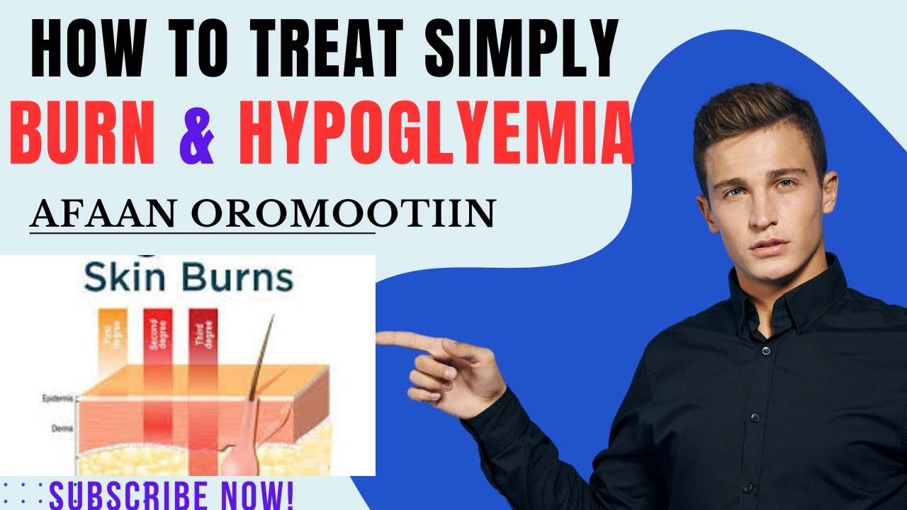 How to manage burn and hypoglycemia patient Afaan Oromootiin .@OROMOHEALTH