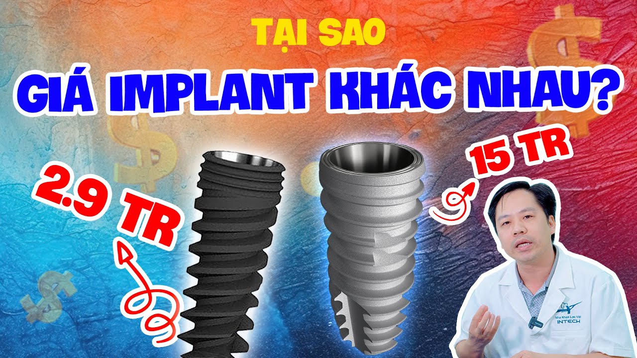 Trồng Răng Implant Giá Bao Nhiêu 2025 - Tại Sao Giá Trồng Răng Implant Lại Khác Nhau?