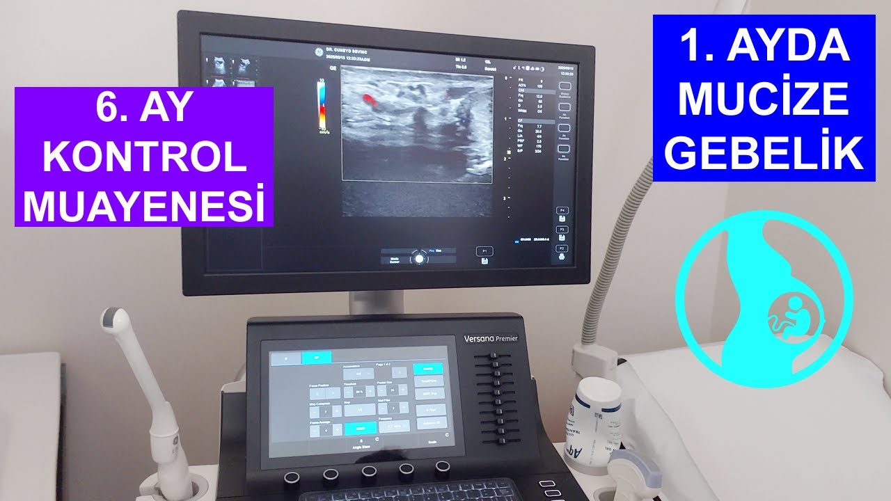 Varikosel Ameliyatı Sonrası 1. AYDA MUCİZE GEBELİK: 6. Ay Kontrol Muayenesi