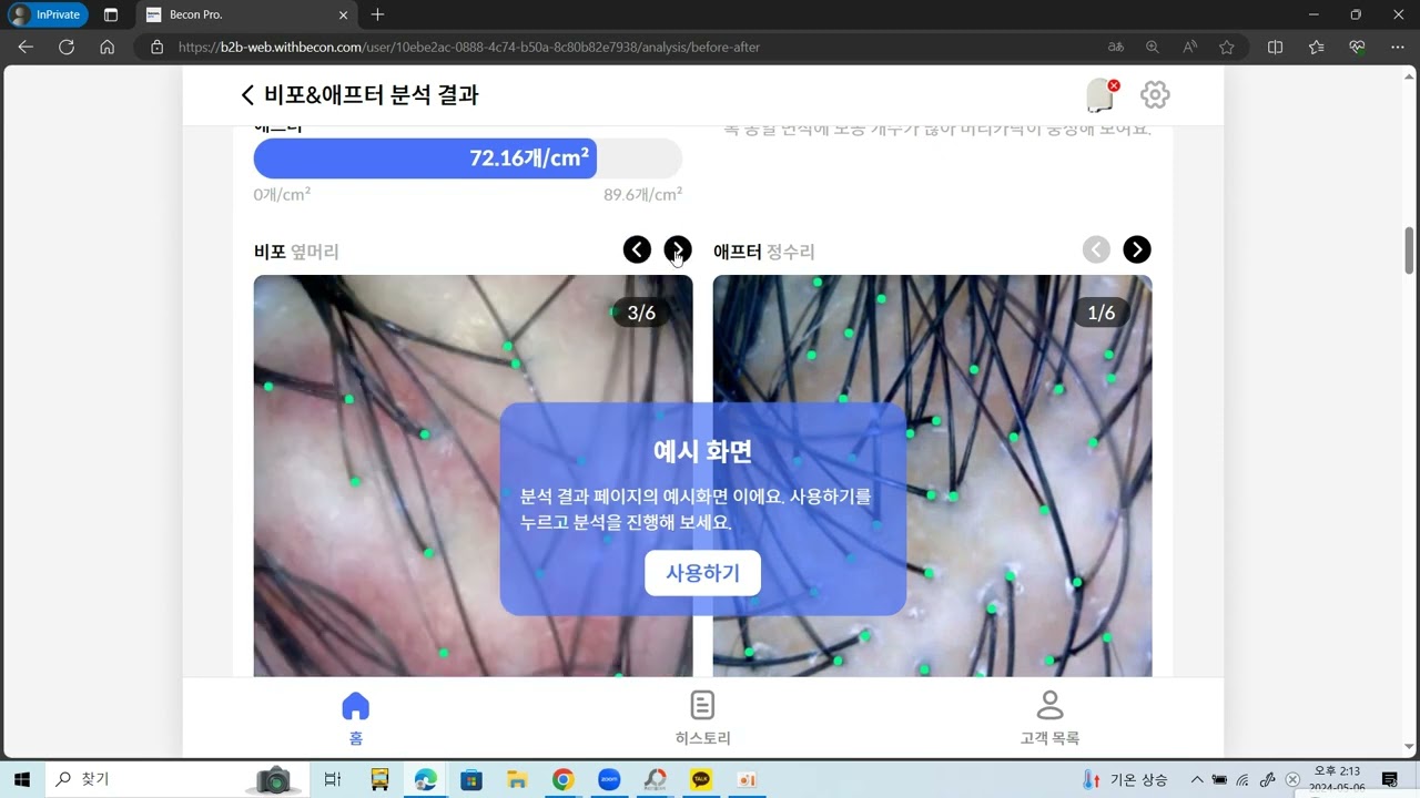 AI두피진단기 비컨에서 사용하는 관리 전,후 분석기법 AI두피진단기 비컨의 특장점 비포에프터분석을 활용해 보십시오.