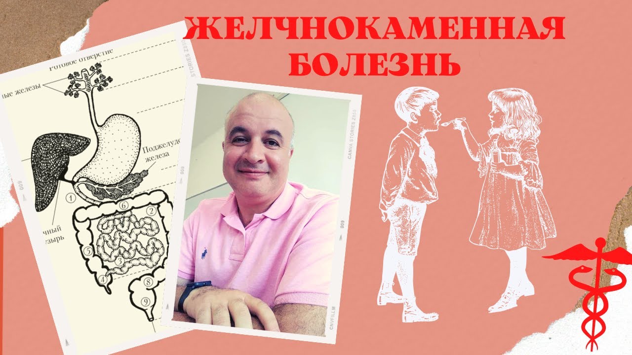 Желчнокаменная болезнь (Холелитиаз). Откуда камни в желчном пузыре?  УДХК