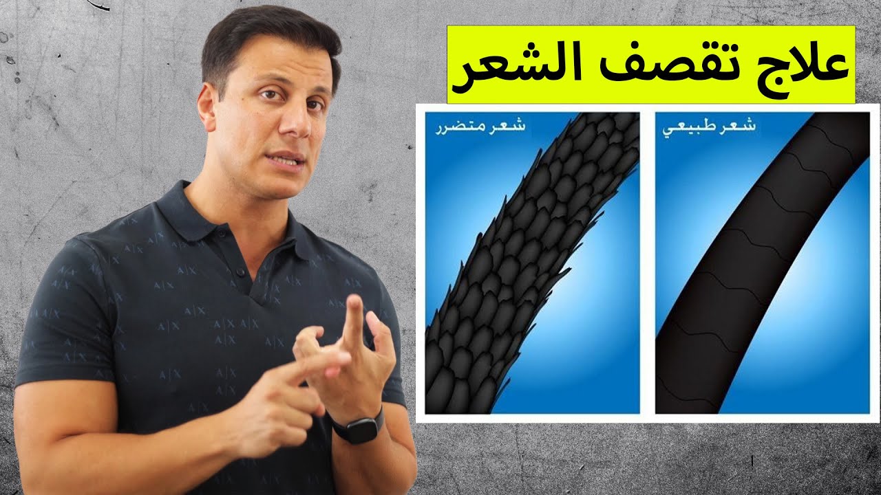اربع طرق للتخلص من التقصف والحصول على شعر صحي وجميل, علاج تقصف الشعر.