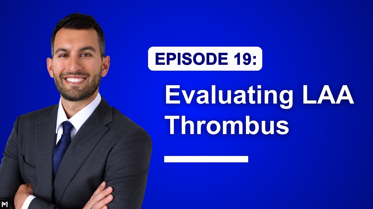 19. How to Evaluate Left Atrial Appendage Thrombus With TEE (Transesophageal Echocardiography)