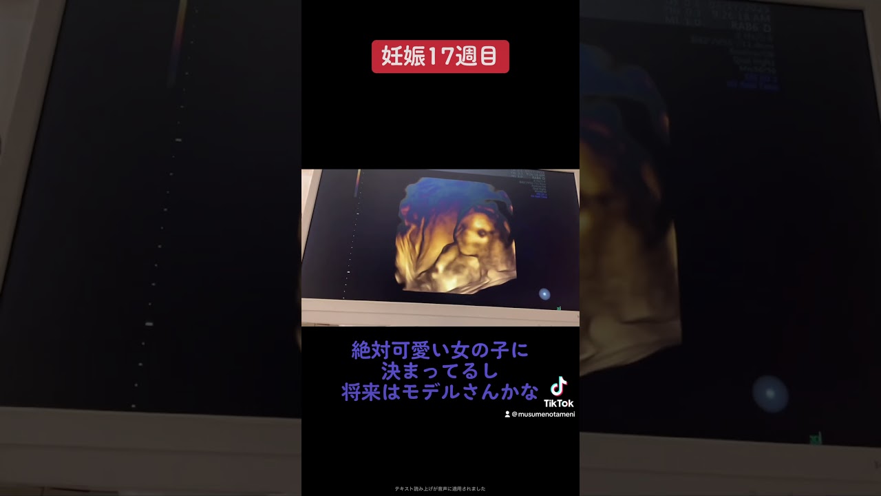妊娠17週目😳性別わかったよ😊 #マタニティ #マタニティライフ