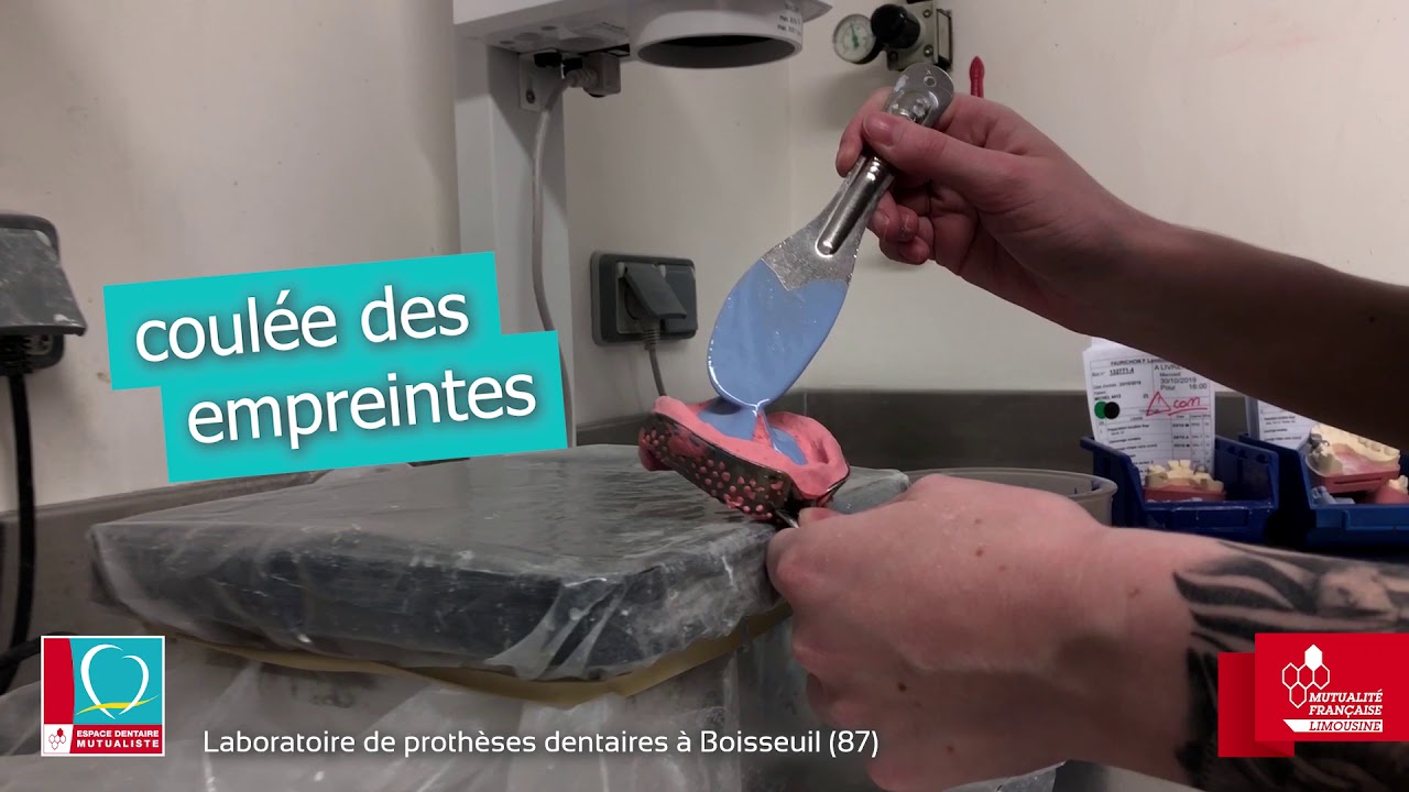 Laboratoire de prothèses dentaires à Boisseuil (87)