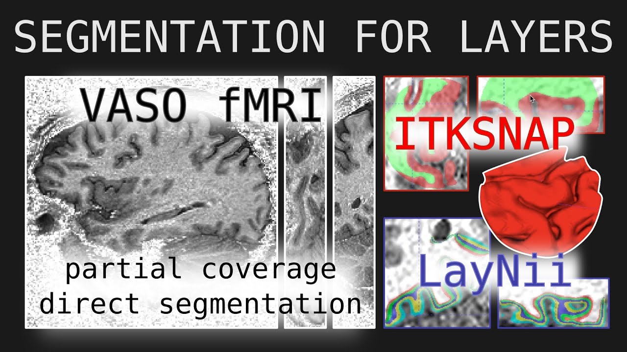 Let's Analyze E001 - High res VASO fMRI cortical segmentation, LayNii layers and more