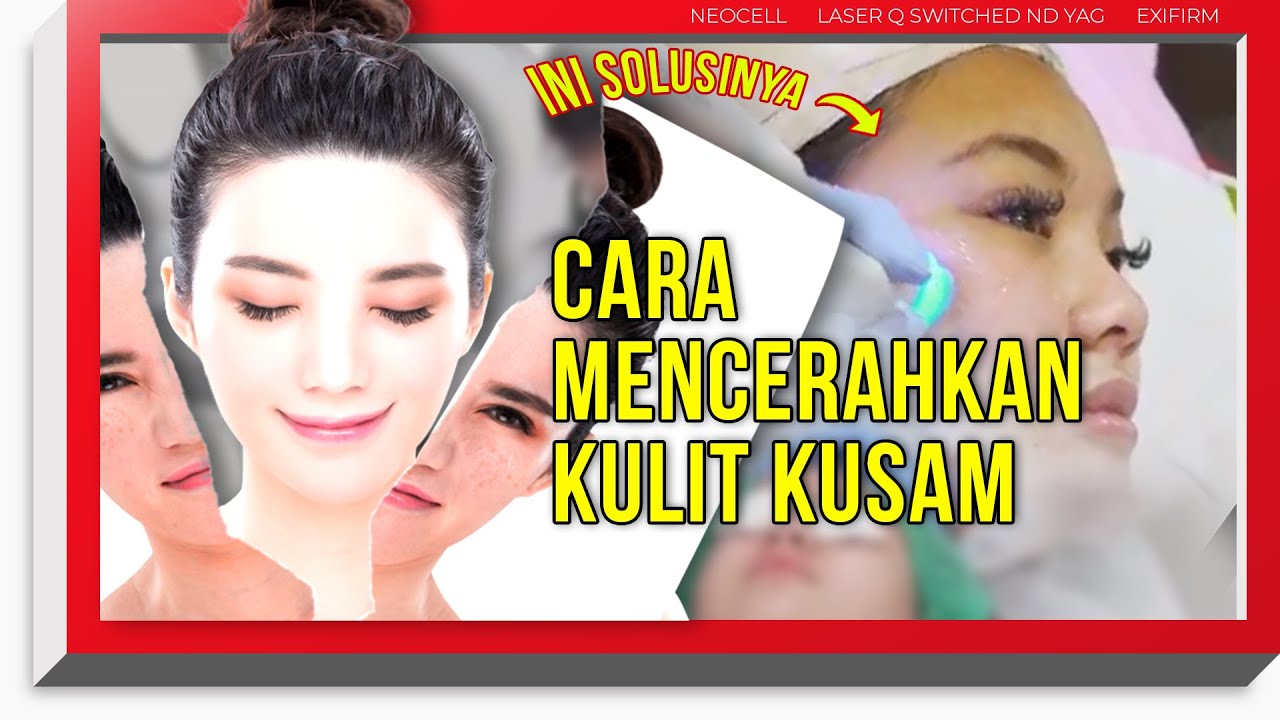 CARA MENCERAHKAN KULIT INSTAN, 3 PERAWATAN KECANTIKAN INI SOLUSINYA!