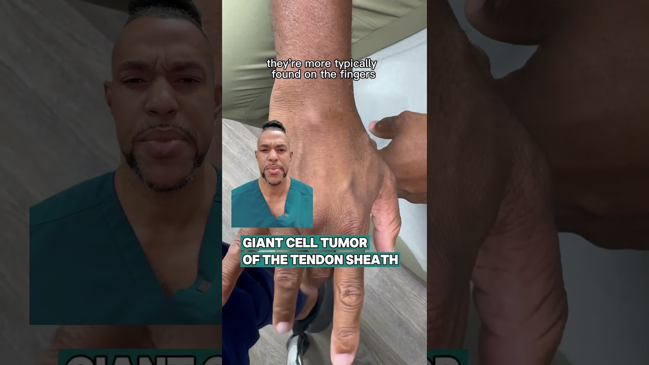 This is #notacyst or ganglion cyst. Sending to hand surgeon to confirm it is not a rare cancer.